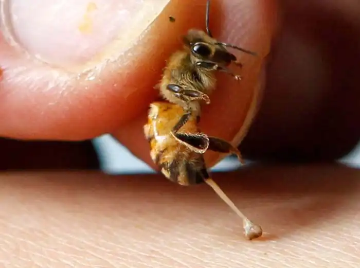 فواید نیش زدن زنبورعسل